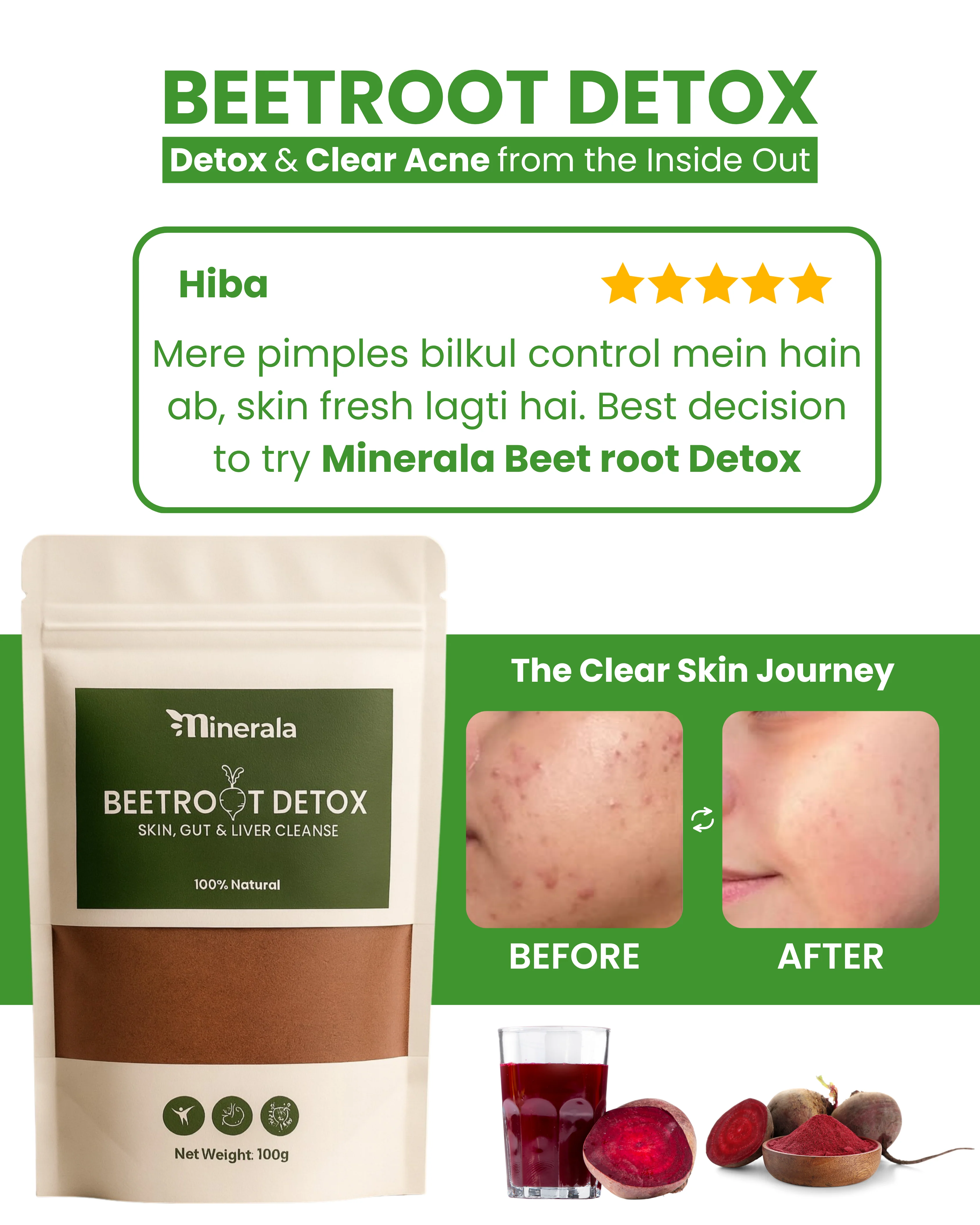 Beetroot Detox for Skin, Gut & Hormone - Image 3
