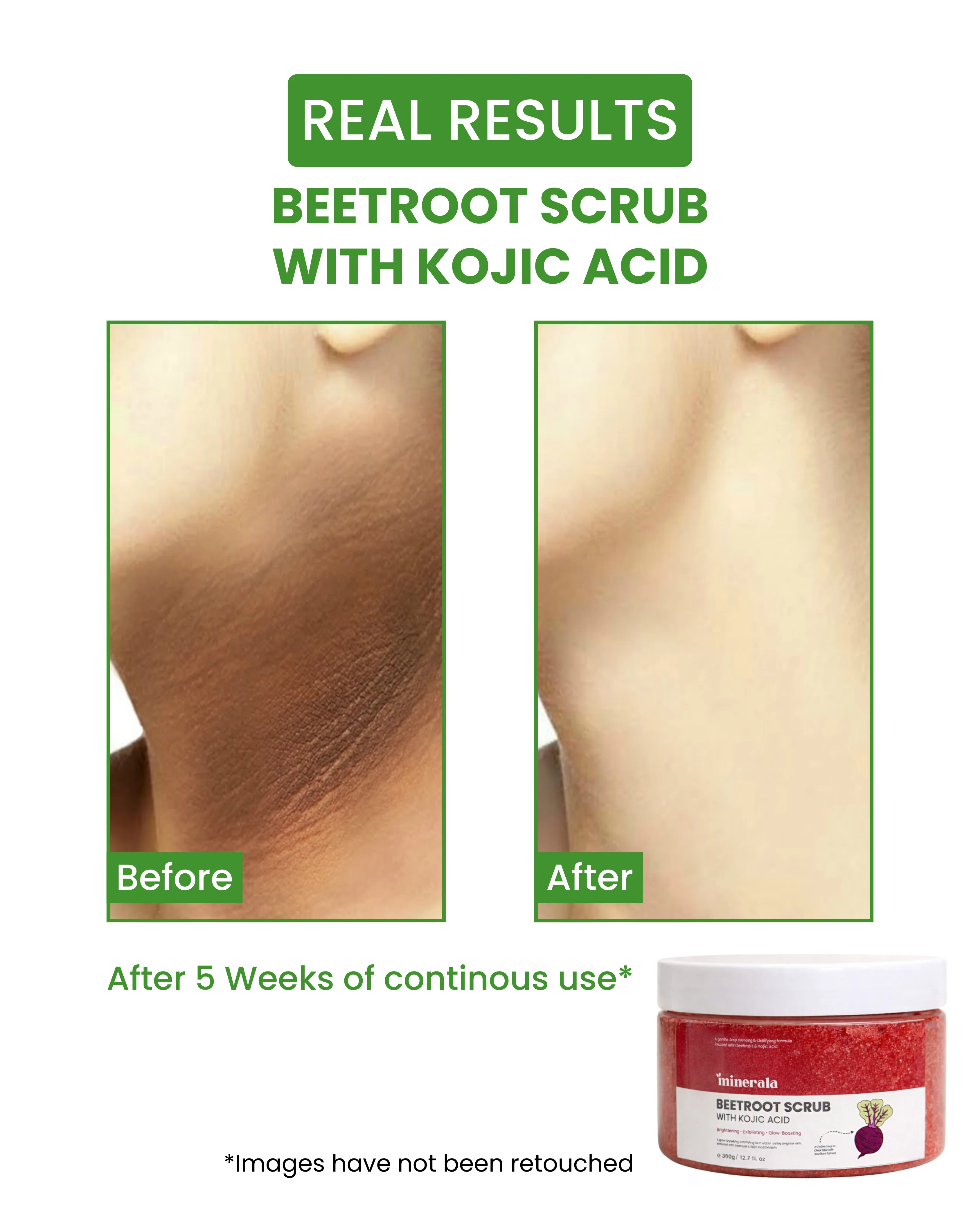 Beetroot Kojic Scrub (Pigmentation, Tan & Glow) - Image 3